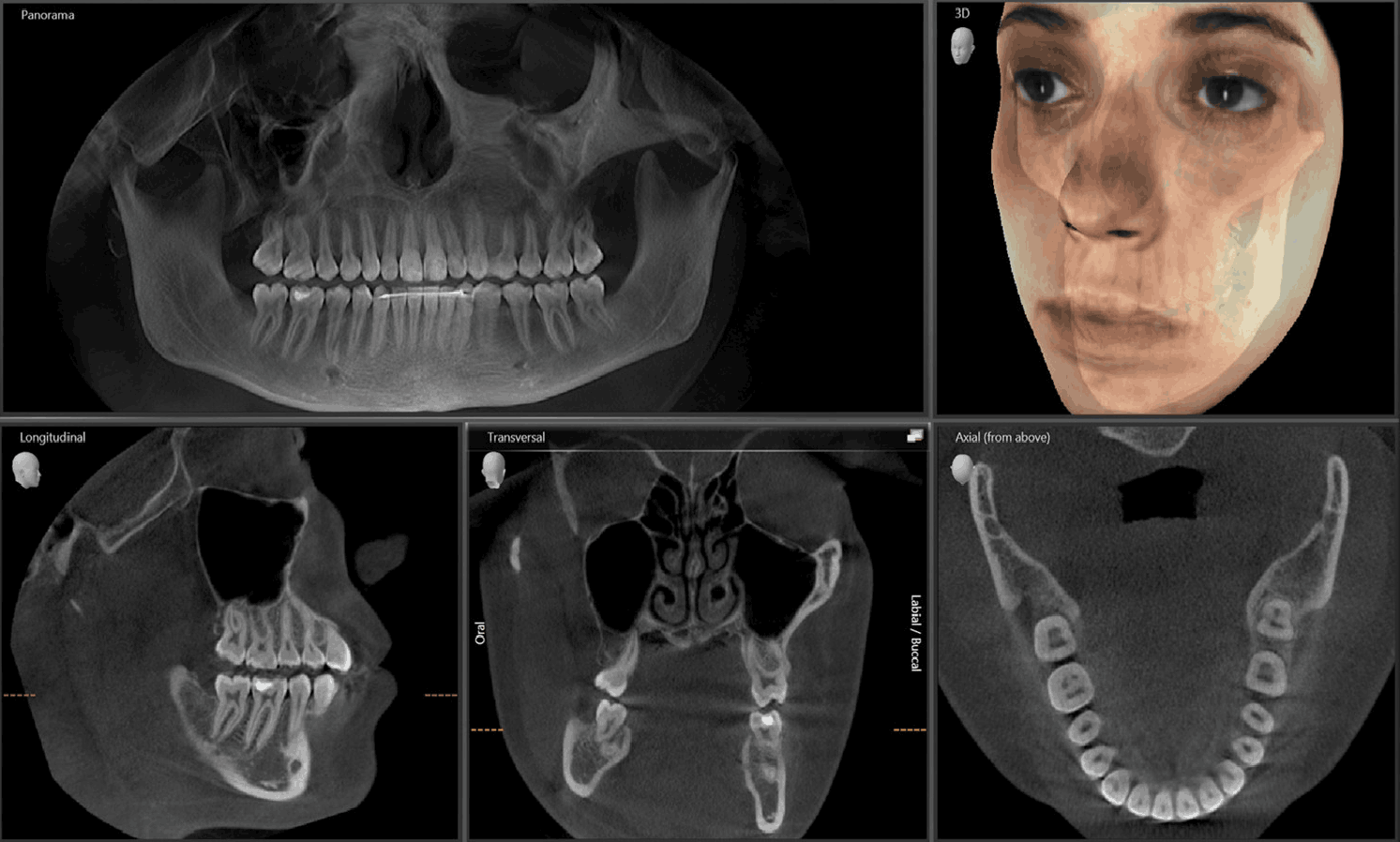 CBCT and Panoramic X Ray – Salloum Dental Clinic