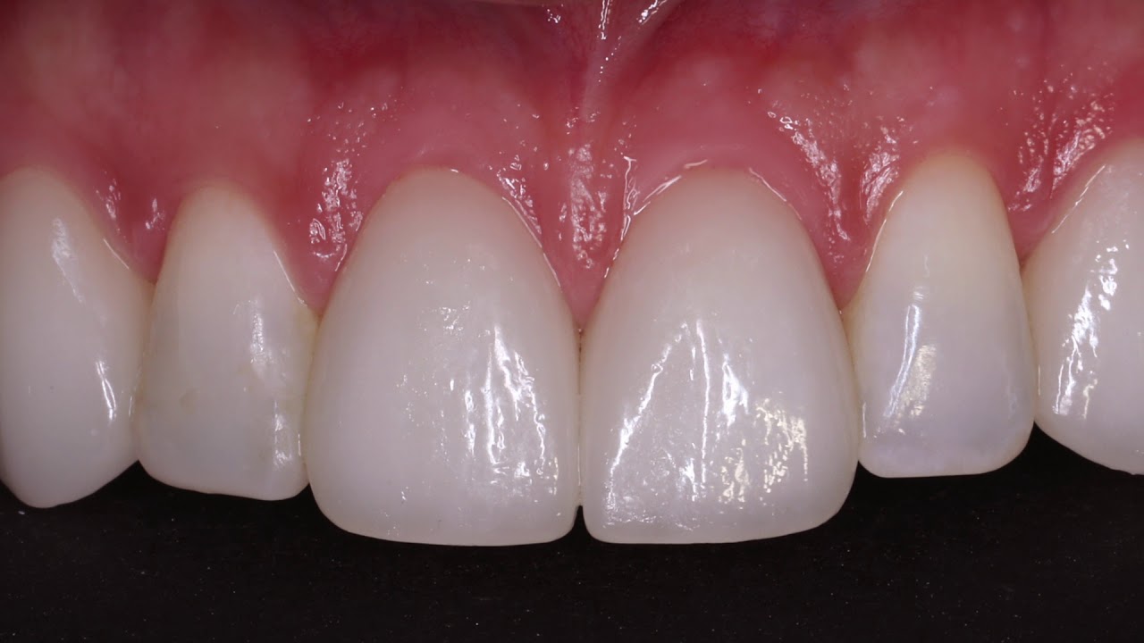 Cosmetic Dentistry Salloum Dental Clinic