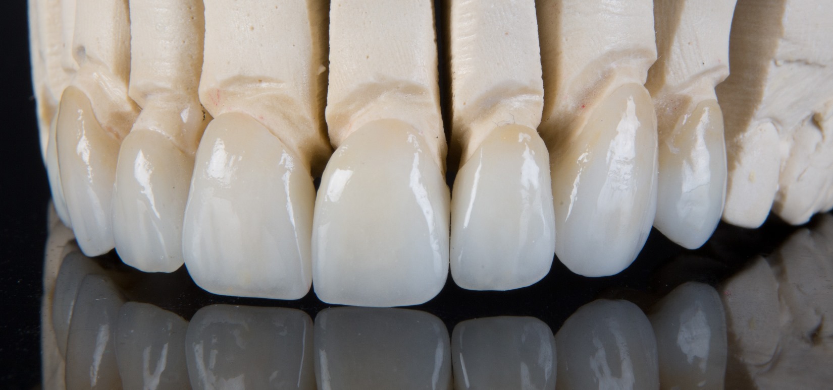 диоксид циркония коронки фото зубов