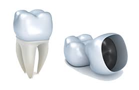 التعويضات الصناعية وتركيبات الأسنان